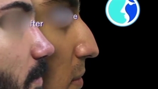 عمل بینی آقایان