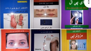 فیلر الانسه خوبه یا نه