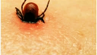 توضیحات دکتر مهدی فرخ سیر در  مورد راههای پیشگیری از تب کریمه کنگو