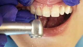 Principle & Basics of Smile Design