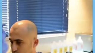 کاشت مو به روش سلولهای بنیادی در ایران! شایعه یا واقعیت؟