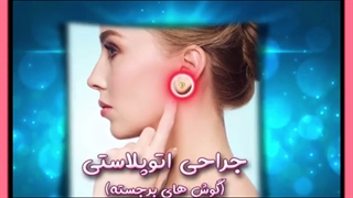 جراحی گوش برجسته یا لیفت گوش چیست ؟