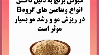 دلایل ریزش مو در زنان جوان و راهکارهای جلوگیری از آن