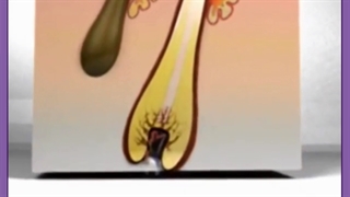 رابطه ریزش مو با بیماری ها و رژیم غذایی