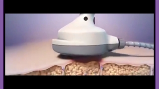 آیا از تکنولوژی هایفوتراپی برای لاغری هم استفاده می شود؟