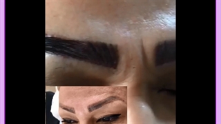 بهترین سن کاشت ابرو طبق نظر پزشکان متخصص