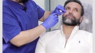 جنجال دوباره نیکبخت این بار با تزریق ژل و بوتاکس بررسی لک صورت