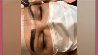 شستشو و استحمام بعد از کاشت ابرو