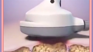 آیا از تکنولوژی هایفوتراپی برای لاغری هم استفاده می شود؟