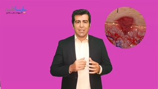 آشنایی با زخم | فروشگاه اینترنتی پارساطب