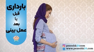 عمل بینی قبل یا بعد از بارداری؟ آیا عمل بینی و بارداری همزمان ممکن است؟