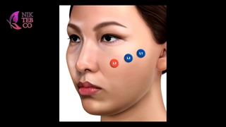 آموزش تزریق ژل به نقاط md codes