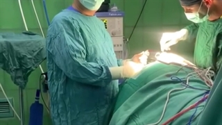 بیماری روماتیسمی ستون فقرات AS