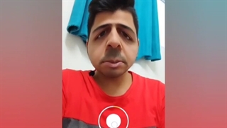 فیلتر اینستاگرام جوکر