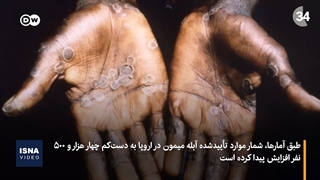 افزایش آبله میمون در اروپا؛ درخواست برای «اقدام فوری»