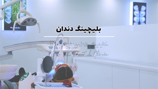 بلیچینگ دندان؛ روشی مطمئن برای سفید کردن دندان درمان جای جوش