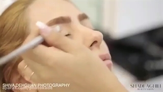 سمانه پاکدل و هادی کاظمی ترمیم سوختگی