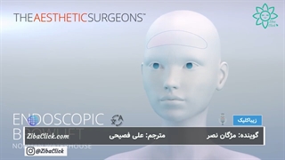 لیفت آندوسکوپیک ابرو