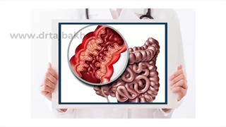 شقاق یا فیشر چیست؟ درمان قطعی شقاق