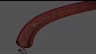 بیمارى عروق محیطى