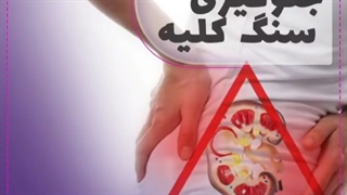 جلوگیری از سنگ کلیه