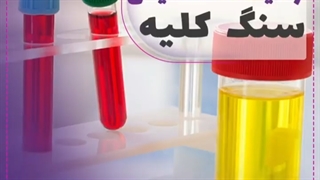 آزمایشاتی برای تشخیص سنگ کلیه