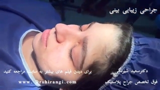 فیلم عمل بینی توسط جراح پلاستیک در ایران