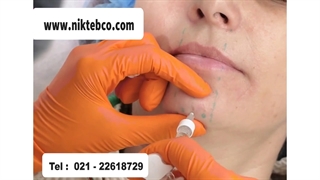 تزریق رووفیل اولترا به چانه