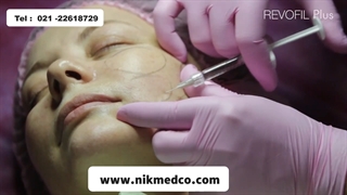 تزریق ژل رووفیل پلاس