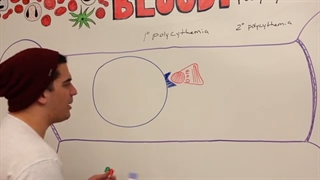 ninja nerd هماتولوژی قسمت پنجم (انواع پلی سیتمی )