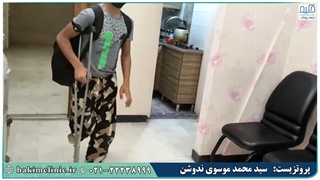 چابکی و چالاکی نوجوانی با پروتز پنجه کربنی- کلینیک حکیم